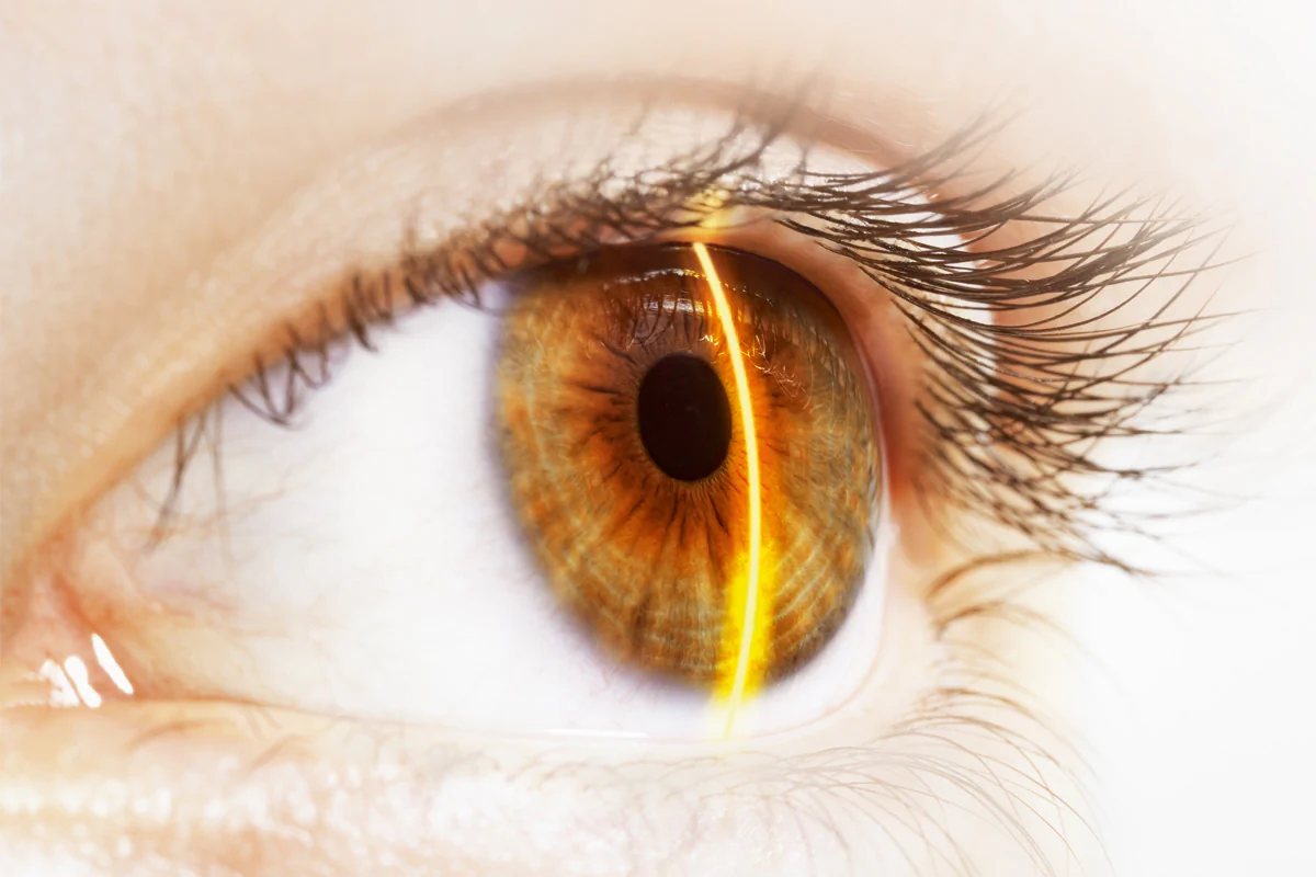 Bildbeschreibung / description: 